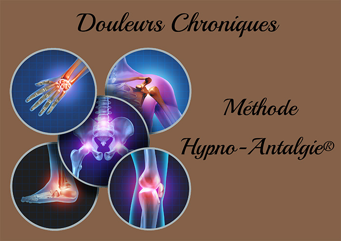 Douleurs Chroniques